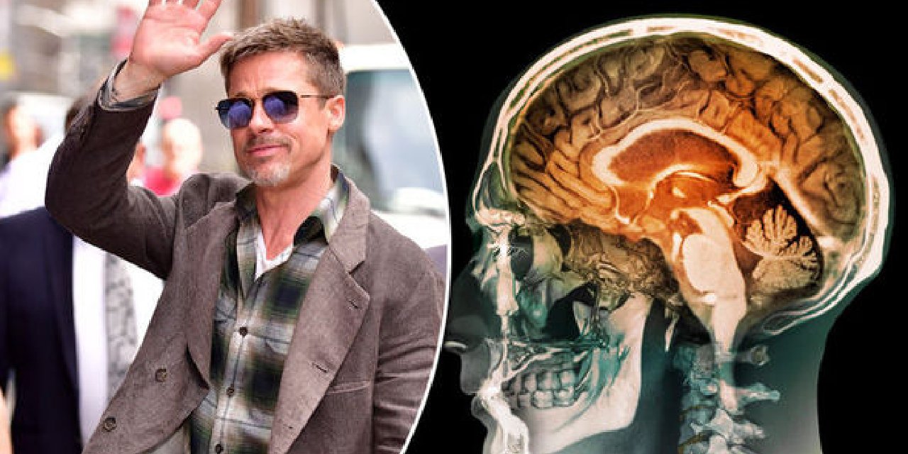 Brad Pitt'in Hastalığı Prosopahnasia Türkiye'de De Çıktı