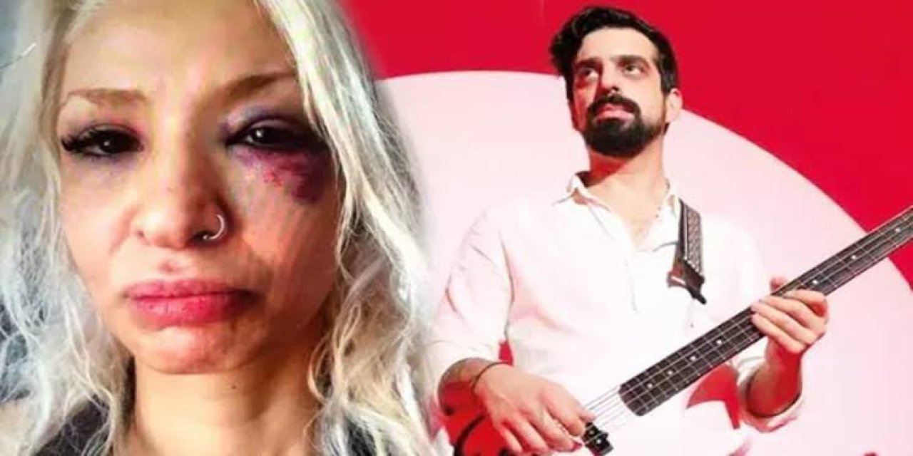 Sevgilisini Dövmüştü! Yüzyüzeyken Konuşuruz'un Gitaristi Hakim Karşısında