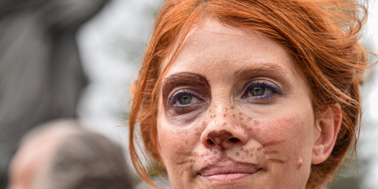 Antalya'da Sokak Hayvanları İçin Eylem: "Kısırlaştır, Aşılat, Yerinde Yaşat"