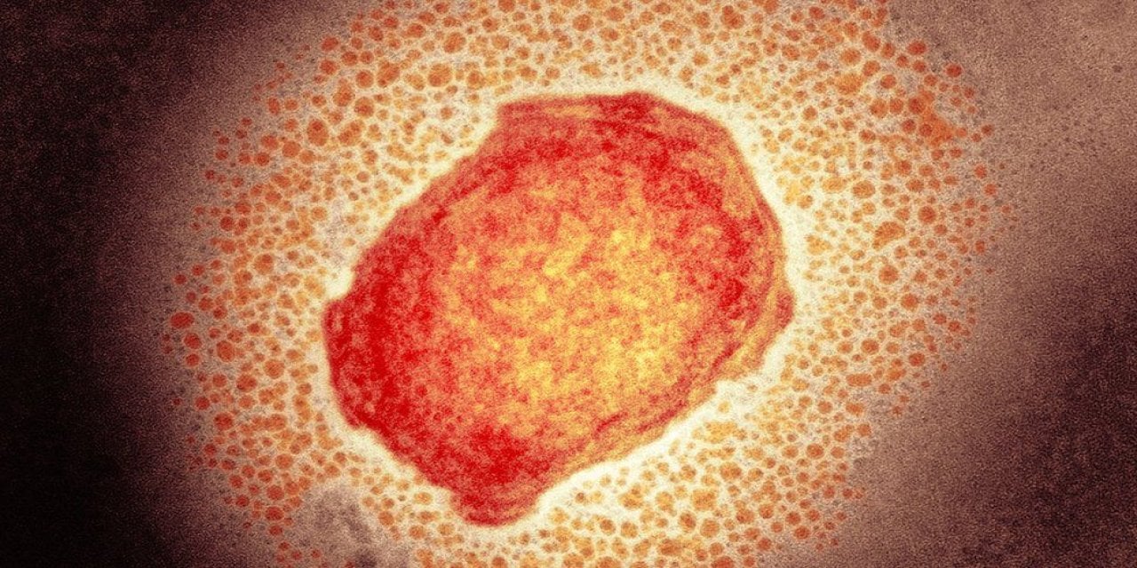 Korkutan M Çiçeği Virüsü! DSÖ Uyardı