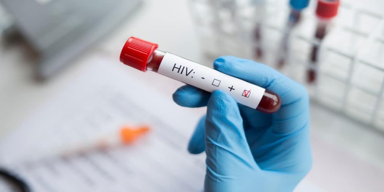 HIV Nedir? Bulaş Yolları Nasıl Gerçekleşir?