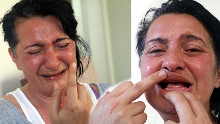 Ağrıdan 32 dişini çektirip ağlayarak ötenazi isteyen kadının son hali sevindirdi