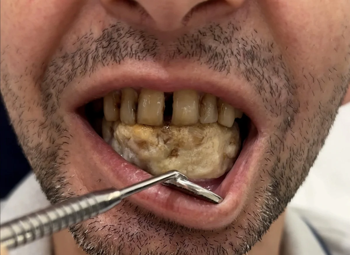 İstanbul'da dişçiye giden hasta diş hekimine hayatının şokunu yaşattı