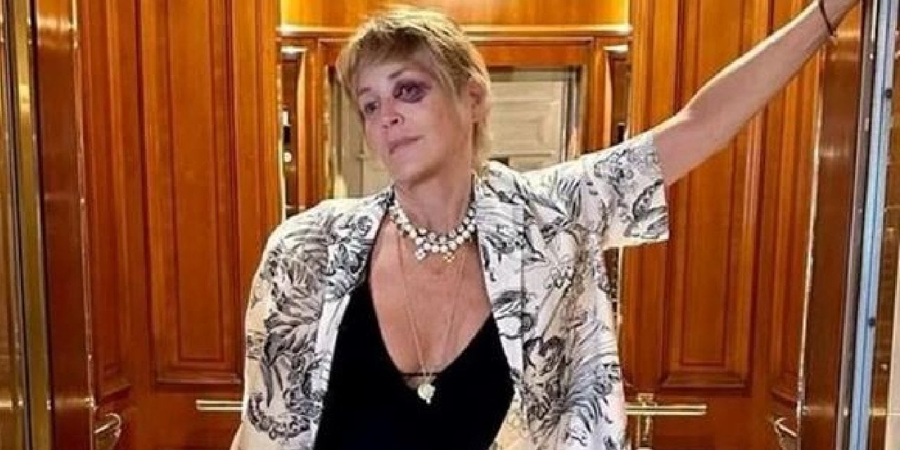 Sharon Stone Bodrum'da kaza geçirdi