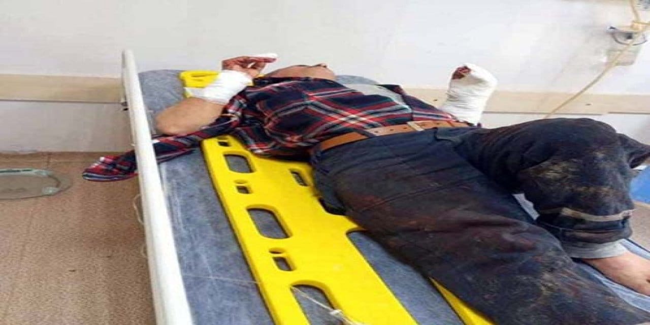 Çorum'da domuz saldırısı: Yaşlı adam ölümden dönü
