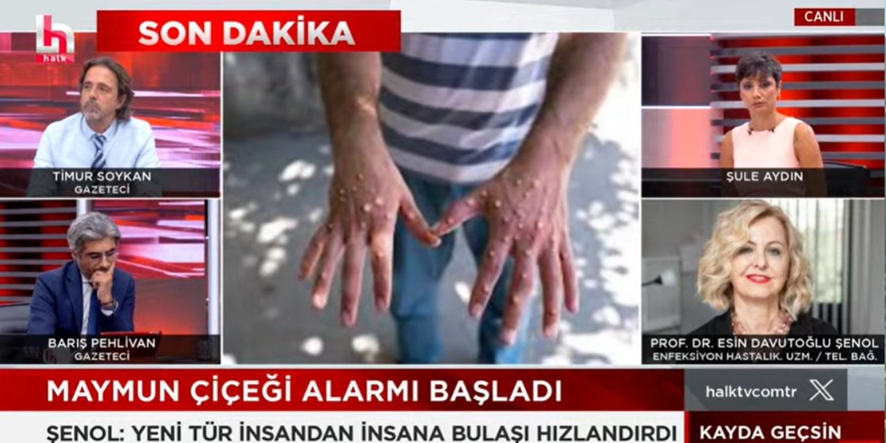 Acil alarm ilan edildi! Uçuş iptali söz konusu! Maymun çiçeği pandemisi mi geliyor