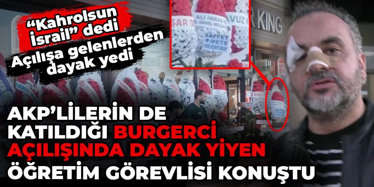 AKP'lilerin de katıldığı burgerci açılışında dayak yiyen öğretim görevlisi konuştu