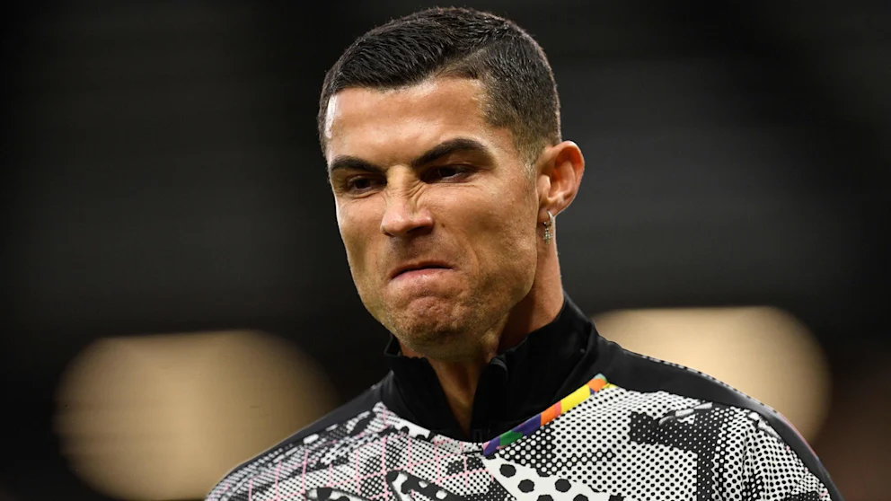 Ronaldo'nun başı botoksu yüzünden dertte