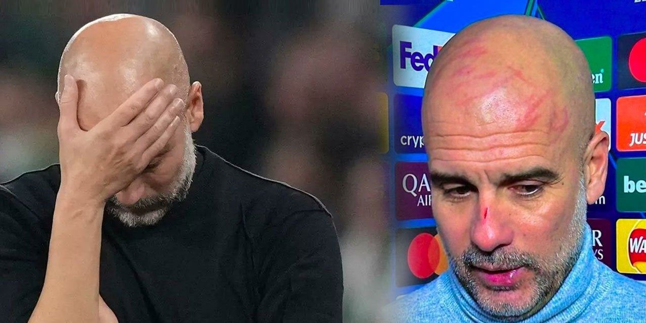 Guardiola canlı yayında açıkladı. Yüzündeki çiziklerin nasıl olduğu ortaya çıktı