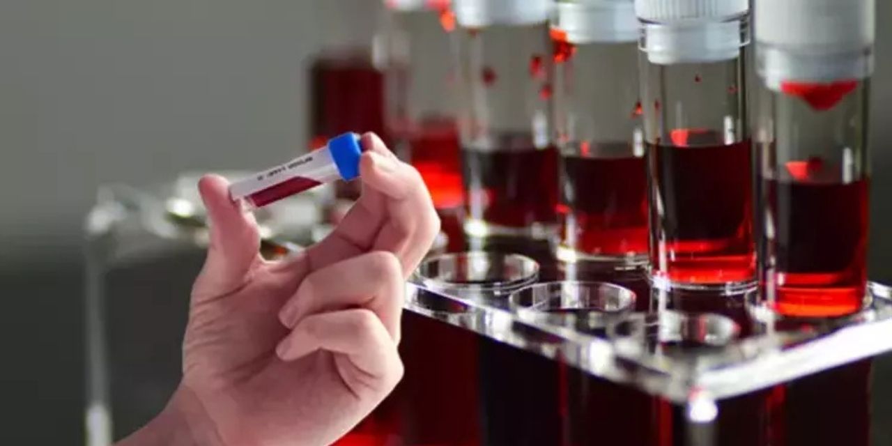 Bilim insanları açıkladı. İşte en zeki kan grupları