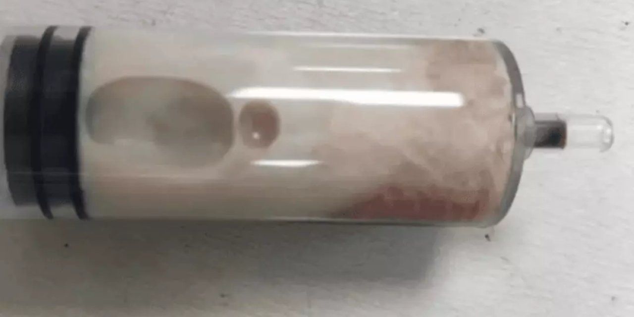 Vücudundan beyaz kan aktı. Doktor sebebini açıkladı