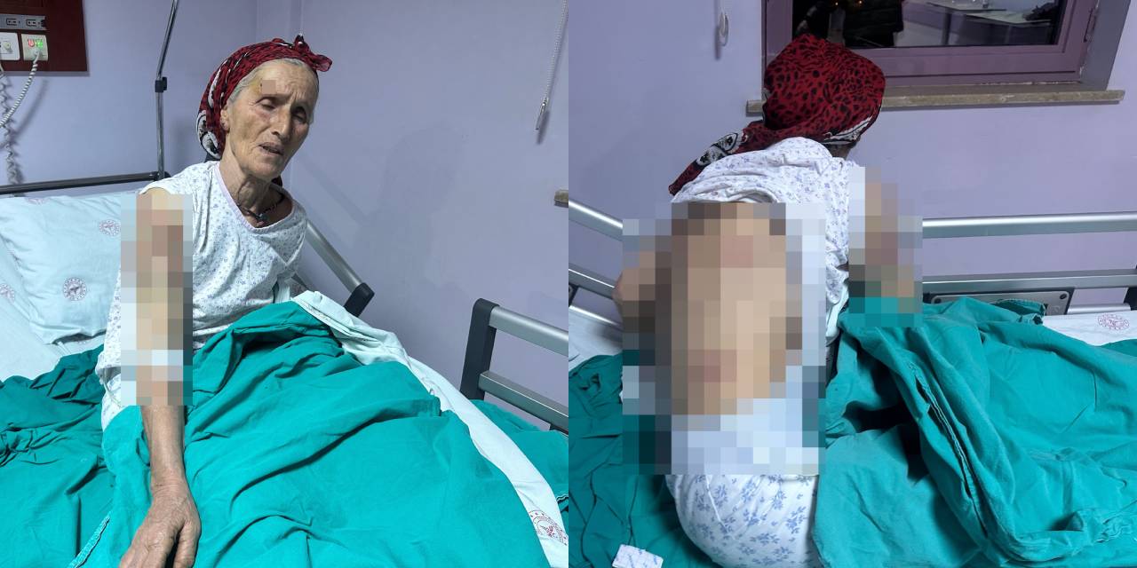 Vücuduna 50 dikiş atılan 65 yaşındaki kadına 7 köpek saldırdı