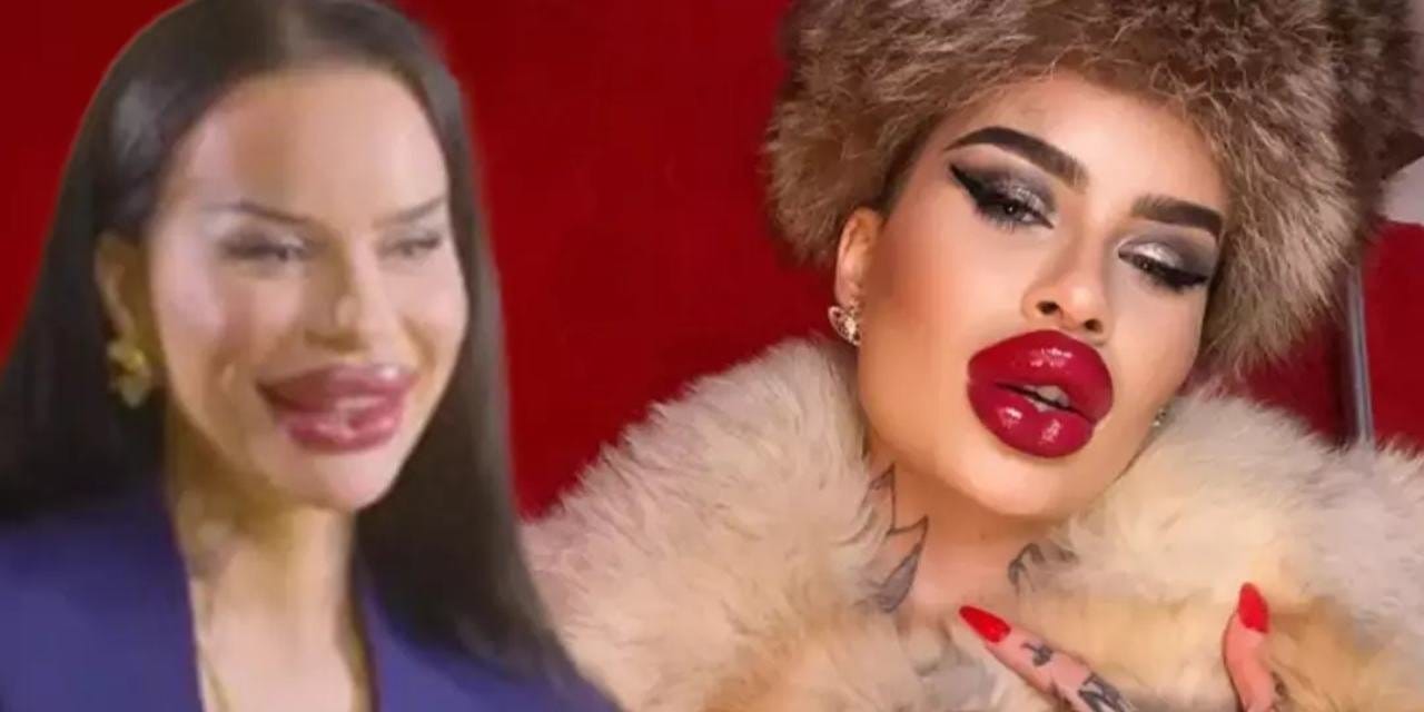 İşte 2 milyonluk yüzü. Fenomenin estetik aşkı ortaya çıktı