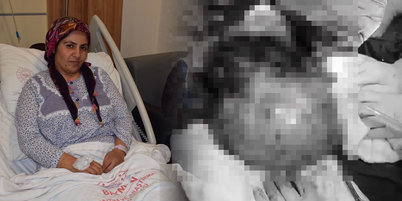 Engelli oğlunu bırakıp 2 yıl hastaneye gidemedi. Karnından 7 kilo kitle çıktı