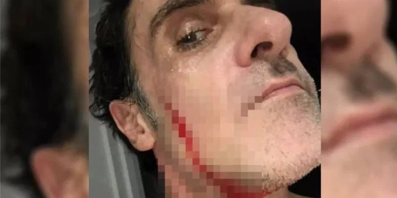 Yüzü kesilince 221 bin TL kazandı