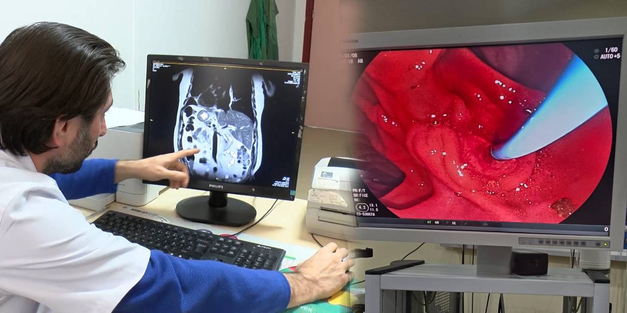 Böyle hastalık görülmedi. Bütün organları ters tarafta