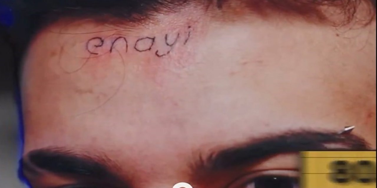 80 bin TL için alnına 'Enayi' dövmesi yaptırdı