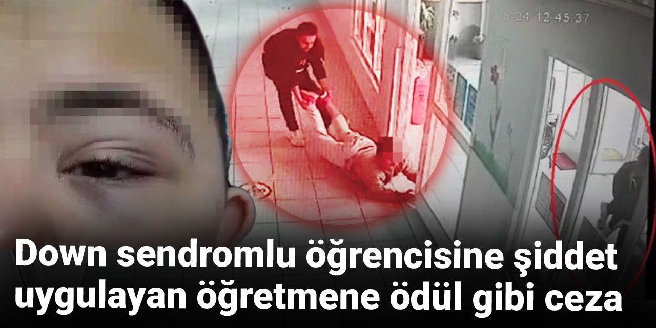 Down sendromlu öğrencisine şiddet uygulayan öğretmene ödül gibi ceza