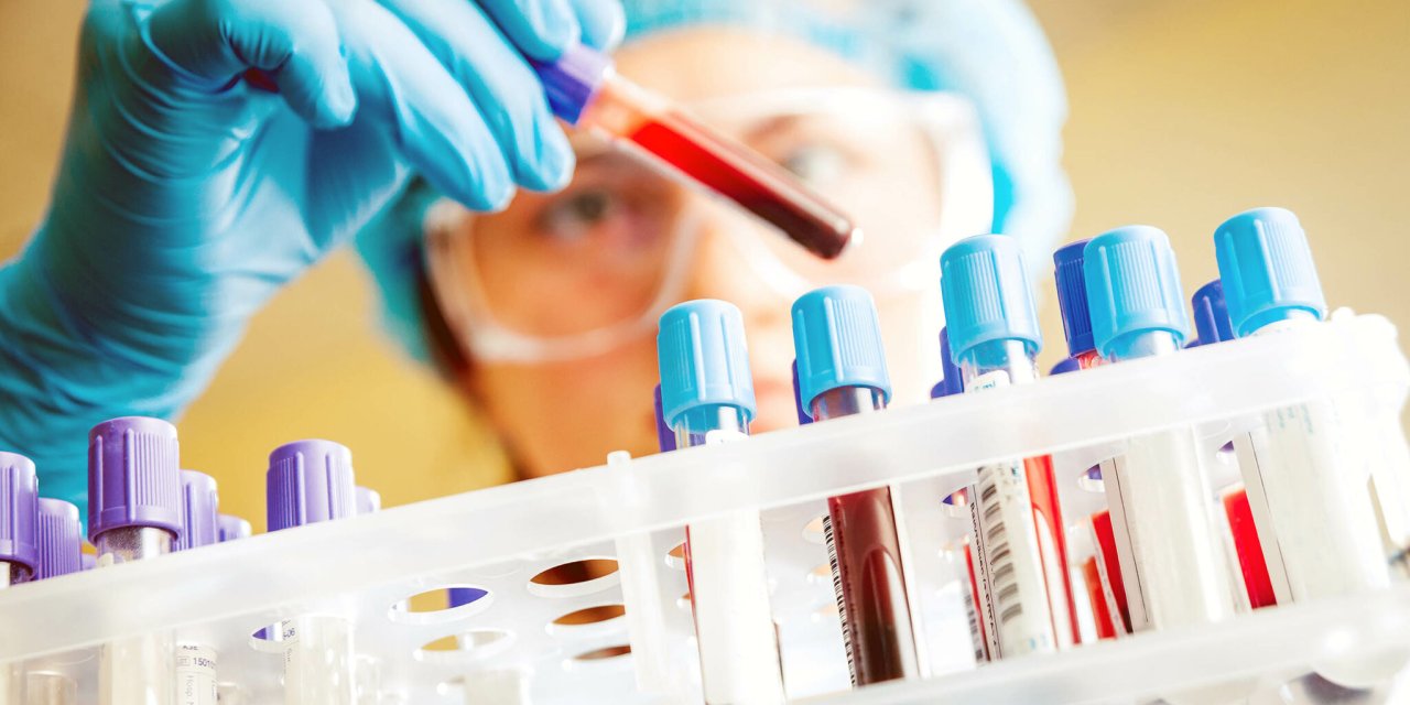 Eğer bu kan grubuna sahipseniz uzun yıllar genç kalma olasılığınız yüksektir