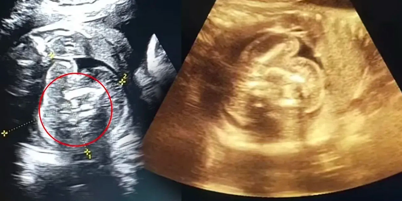 Tıp dünyası şaşkına döndü: Dünyada sadece 200 kişinin başına geldi