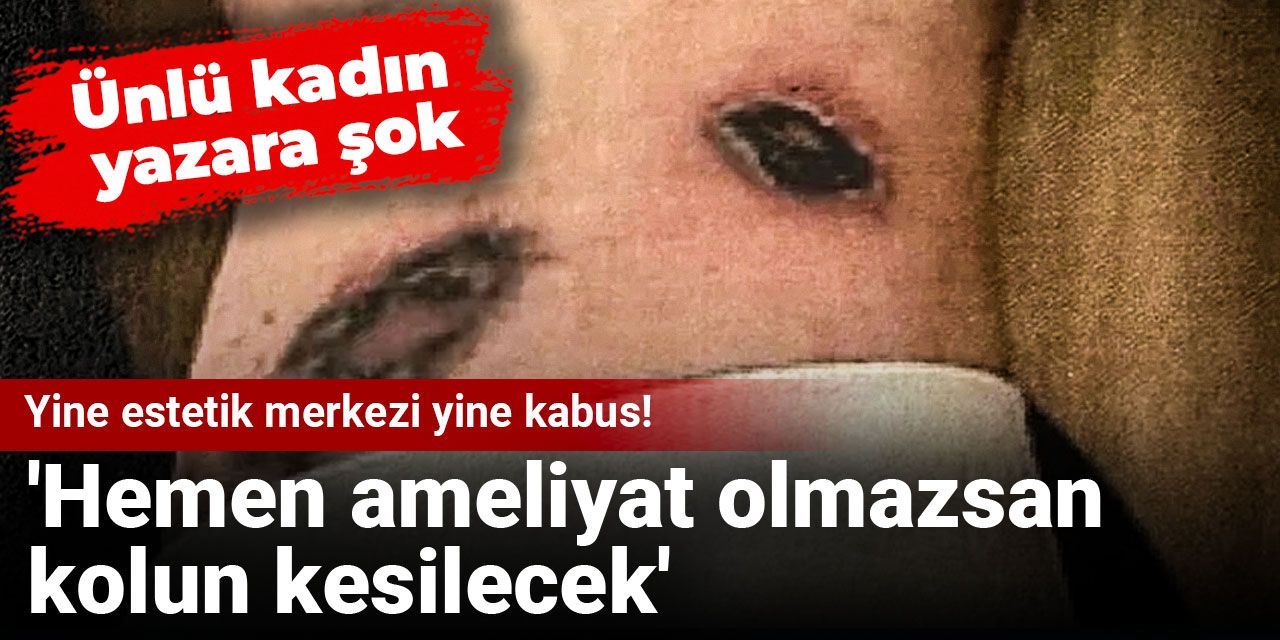 Yine estetik merkezi yine kabus! Ünlü kadın yazara şok! 'Hemen ameliyat olmazsan kolun kesilecek'