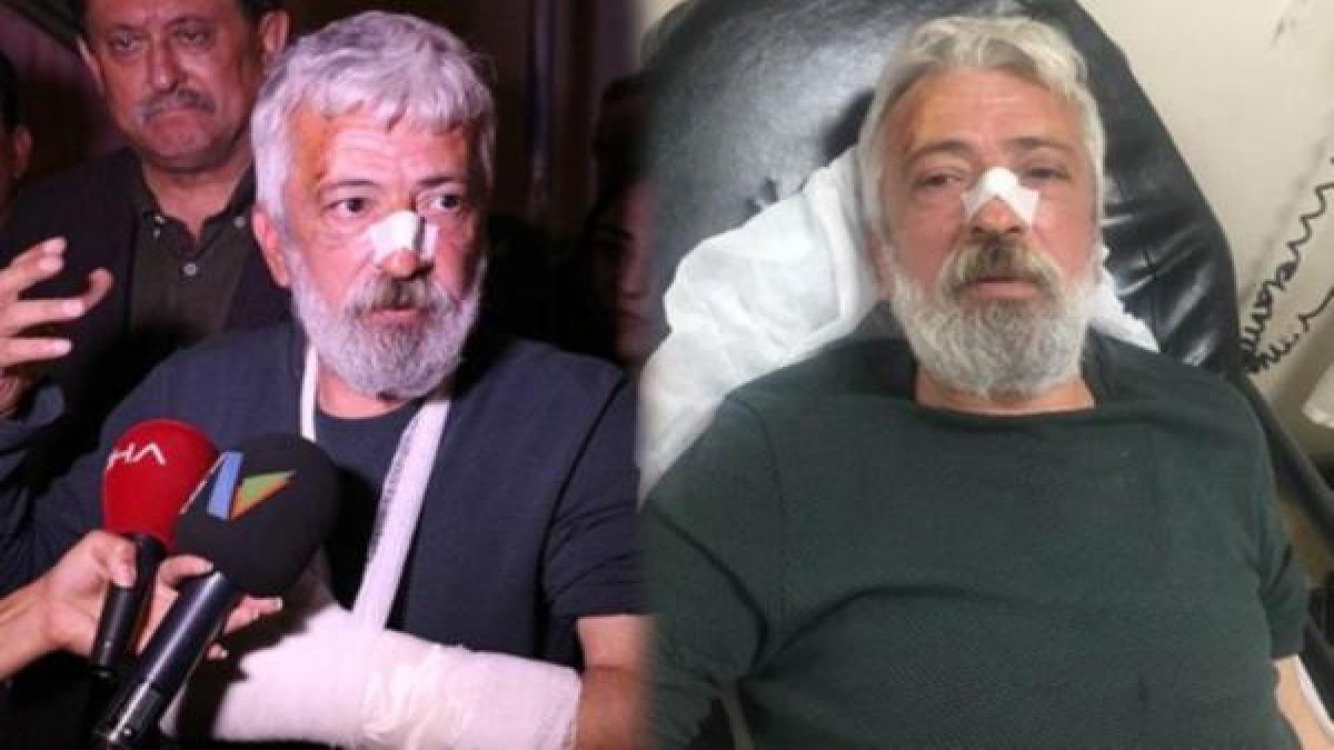 Gazeteciye saldıran MHP'li başkanın şoförü çıktı