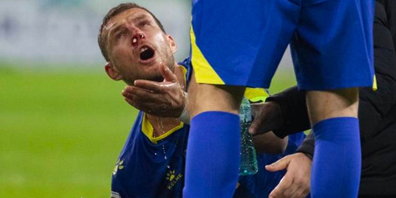 Dzeko'nun son durumu belli oldu