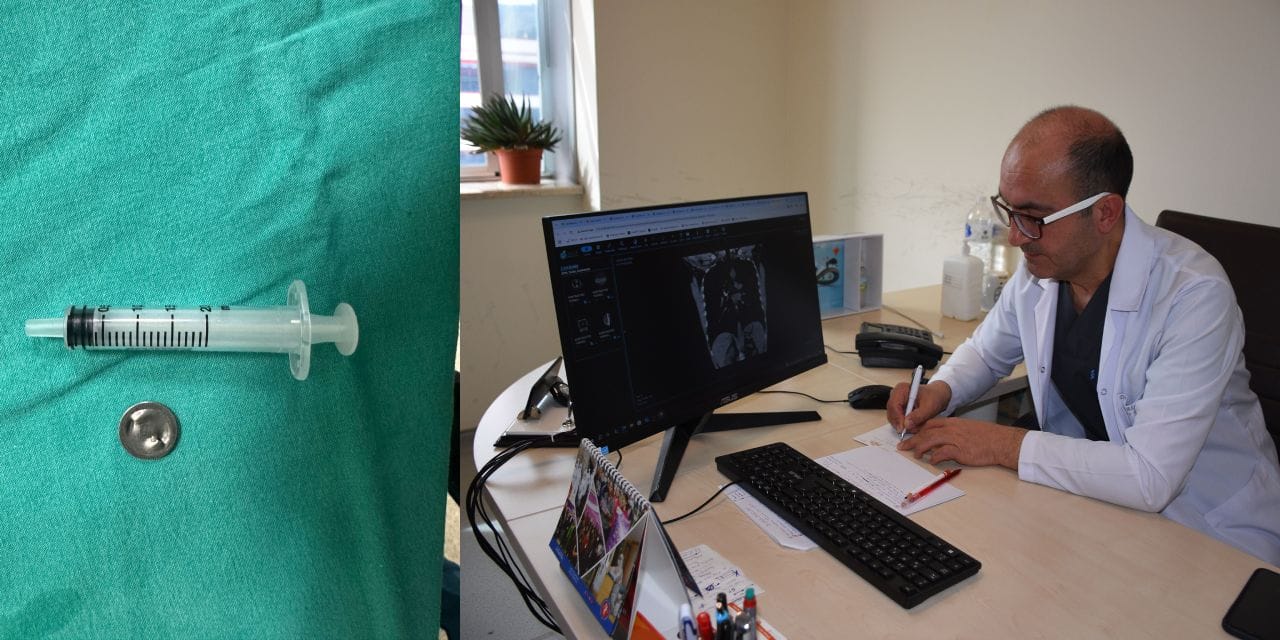 12 milimetrelik tehlike: Akciğerden çıkarıldı