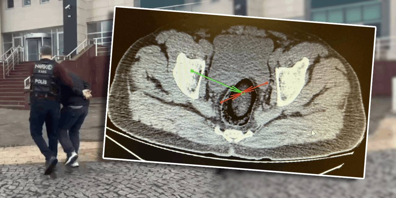 İranlı yolcunun uyuşturucu zulası ağızları açık bıraktı