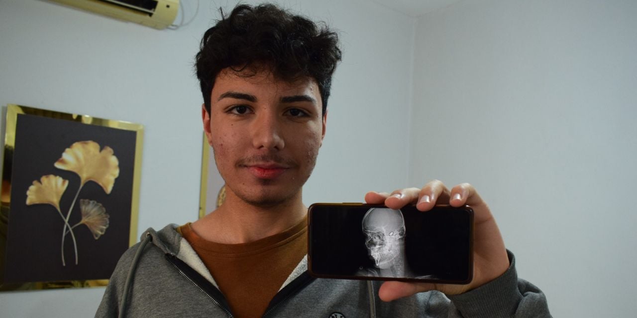 1,5 yıldır başındaki mermiyle yaşıyor