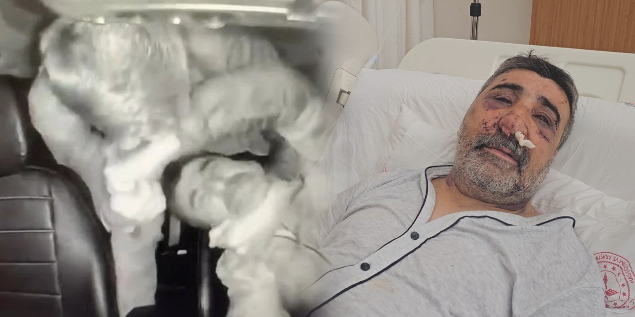 Yoğun bakımdan çıkan taksici İngiliz boksör dehşetini anlattı