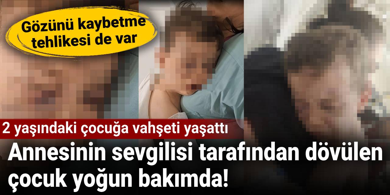 2 yaşındaki çocuğa vahşeti yaşattı: Annesinin sevgilisi tarafından dövülen çocuk yoğun bakımda!
