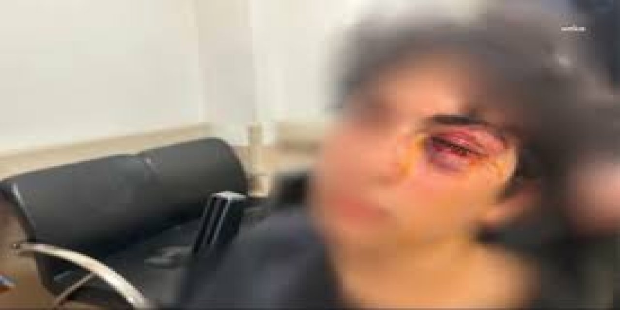 CHP standında 15 yaşındaki çocuğu darbeden 3 zanlı yakalandı