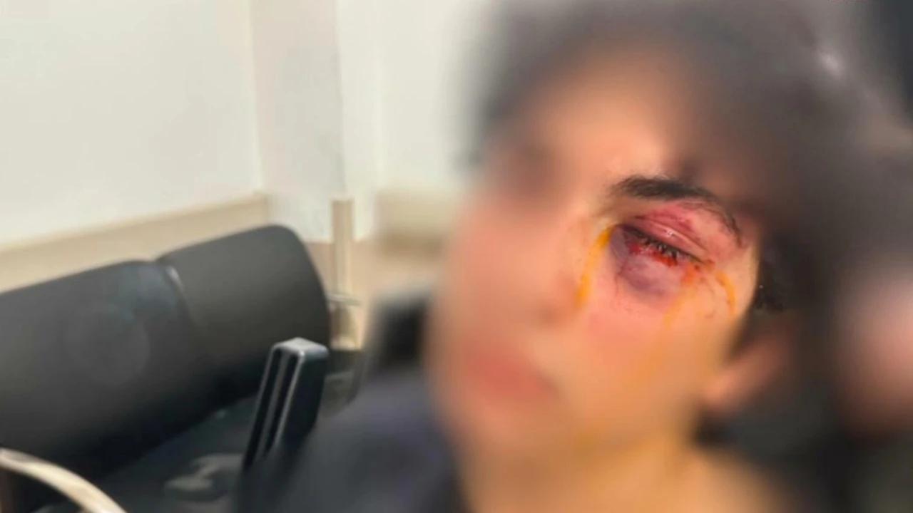 CHP standındaki çocuğa saldıran tutuklandı