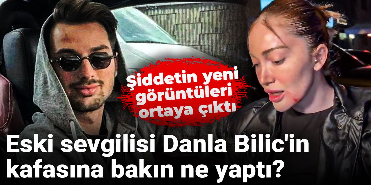 Eski sevgilisi Danla Bilic'in kafasına bakın ne yaptı? Şiddetin yeni görüntüleri ortaya çıktı