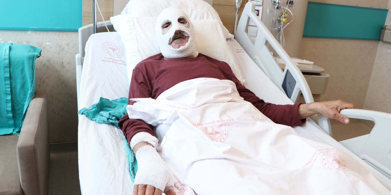 Tüpü çakmakla kontrol etti hastanelik oldu