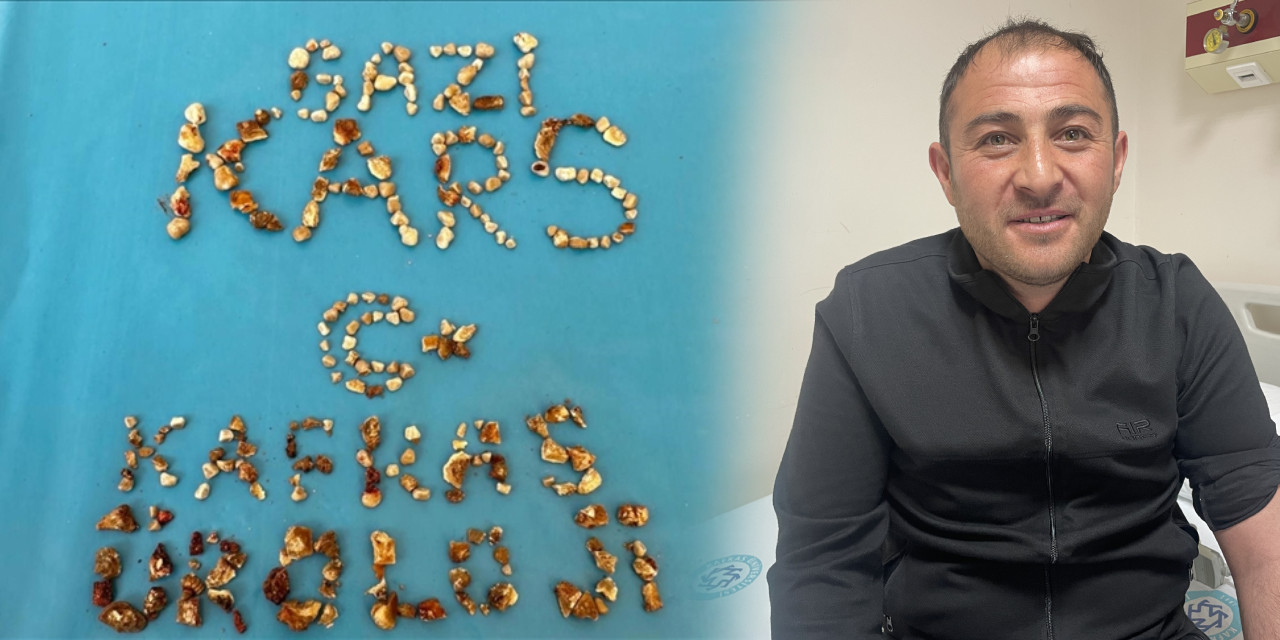 Taş ocağı mübarek! Böbreğinden çıktı hepsini de eve götürdü