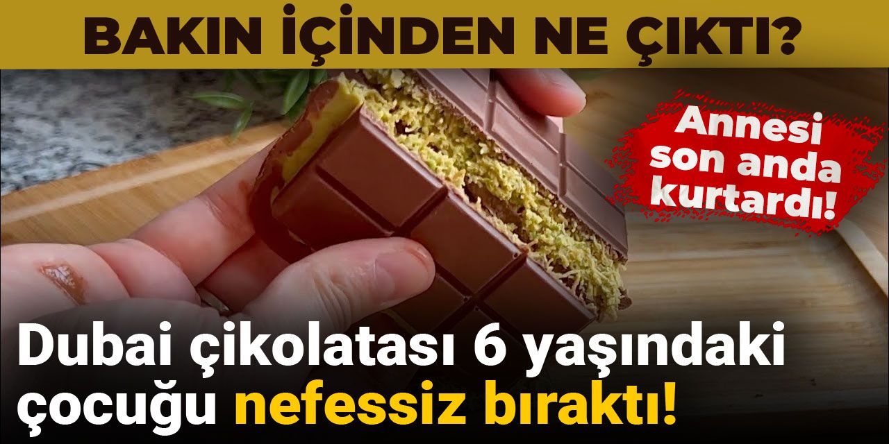 Dubai çikolatası 6 yaşındaki çocuğu nefessiz bıraktı! Bakın içinden ne çıktı