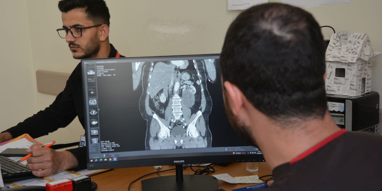 Karın şişliği için başvuran hastaya 23 santimlik şok