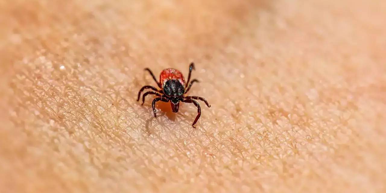 Uzmanı uyardı: Kene vücudunuzdaysa bunu asla yapmayın!