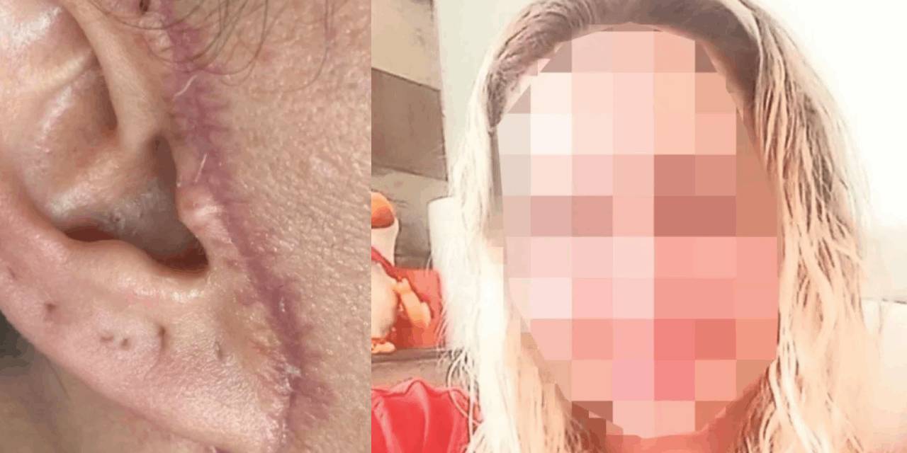 Sadece yüzünü gerdirecekti: Hayatı karardı!