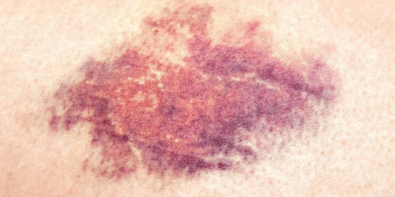 Bu belirtiler sinsice geliyor: Fark etmesi zor ama sonuç ağır!