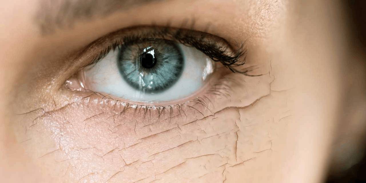 Kuru göz sorunu yaşıyorsanız bu tedavi yöntemlerini bilmelisiniz!