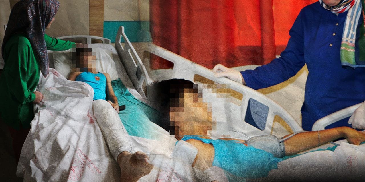 Akılalmaz olay! Şaka olsun diye arkadaşını ateşe verdi