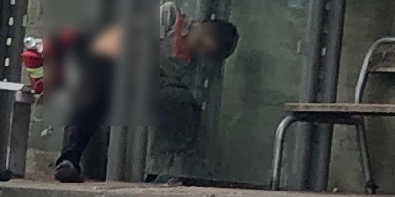 Hastaneden çıkar çıkmaz canından oldu