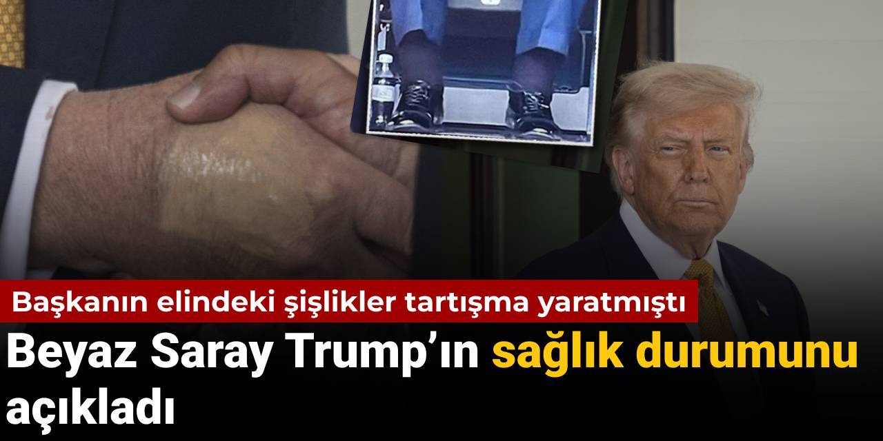 79 yaşındaki başkanın elindeki doku hasarı tartışma yaratmıştı: Beyaz Saray Trump'ın sağlık durumunu açıkladı