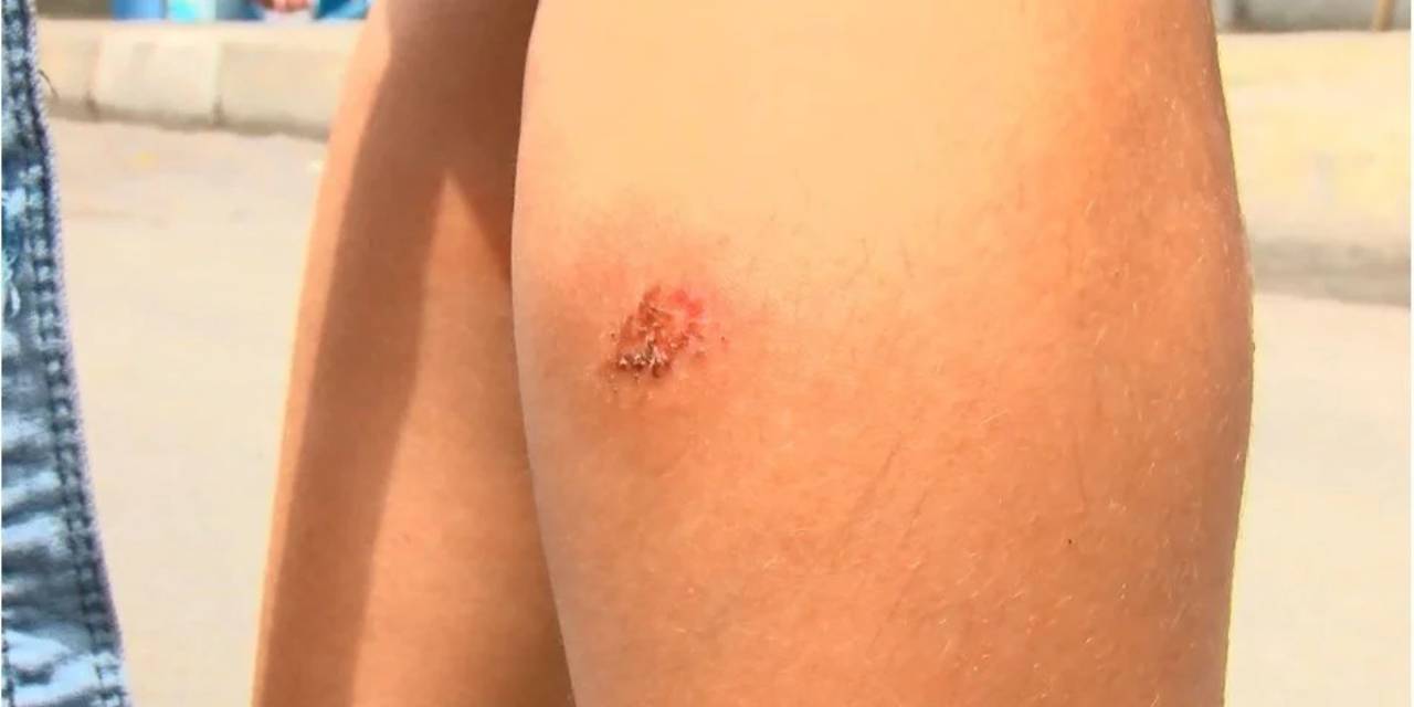 Bu kez o Çinlileri yedi! Vaka sayısı 4 bine çıktı