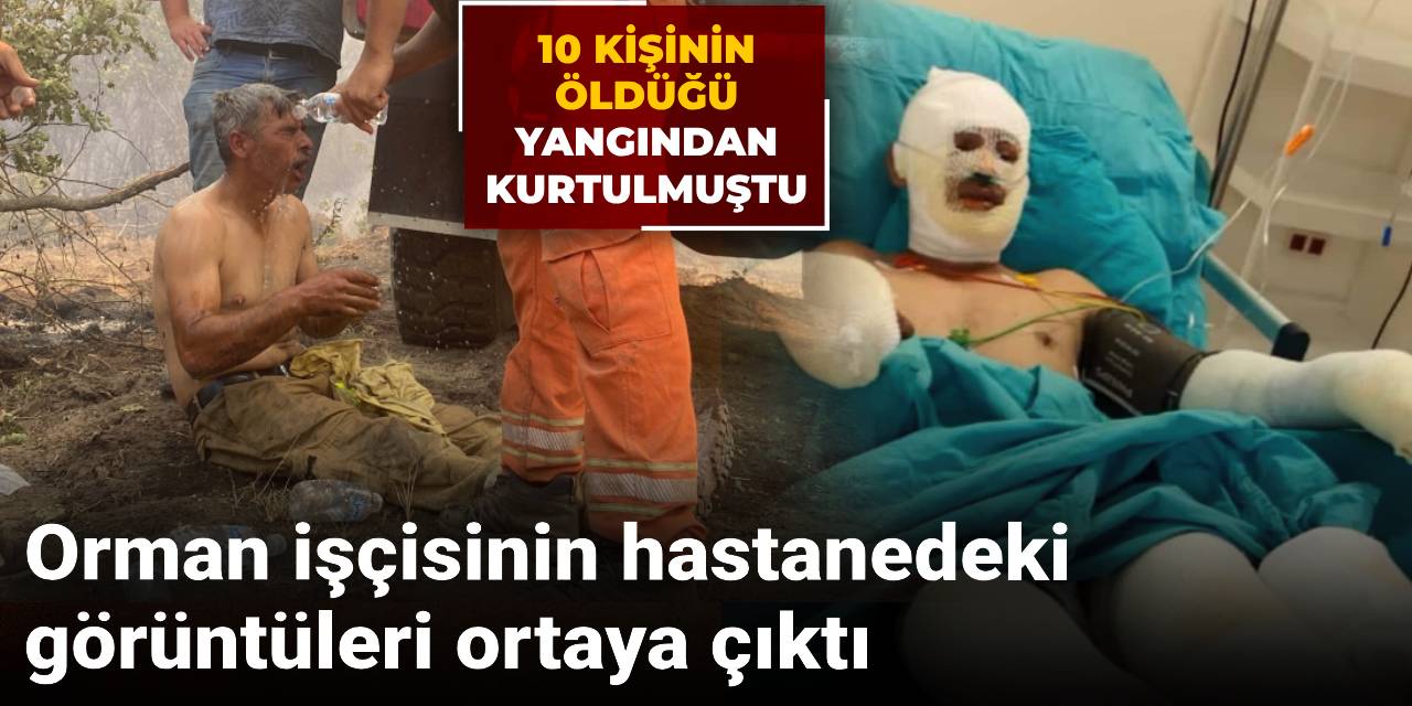 10 kişinin öldüğü yangından kurtulmuştu: Orman işçisinin hastanedeki görüntüleri ortaya çıktı