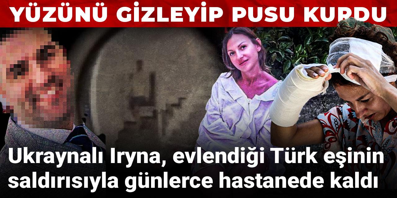 Yüzünü gizleyip pusu kurdu: Ukraynalı Iryna, evlendiği Türk eşinin saldırısıyla günlerce hastanede kaldı
