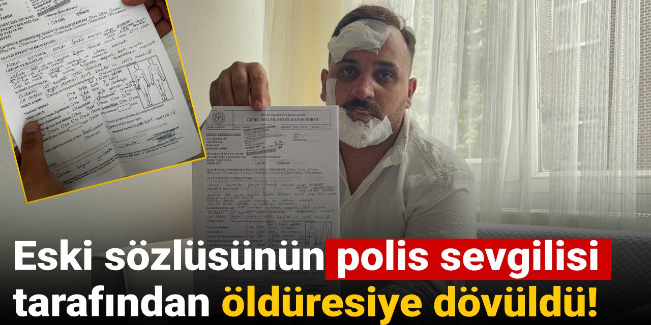 Eski sözlüsünün polis sevgilisi tarafından öldüresiye dövüldü!